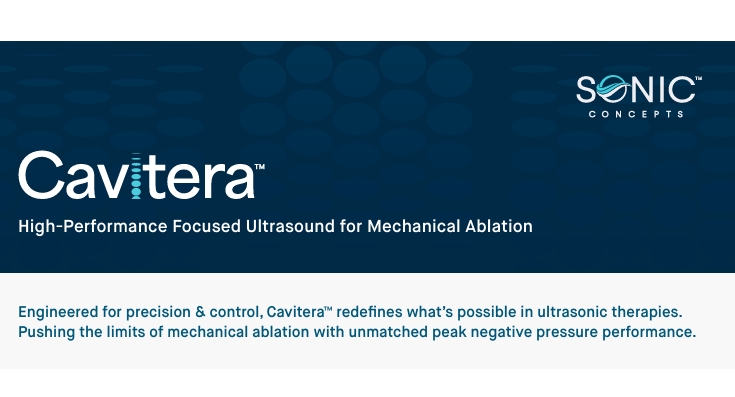 Cavitera：用于机械消融的高性能聚焦超声技术